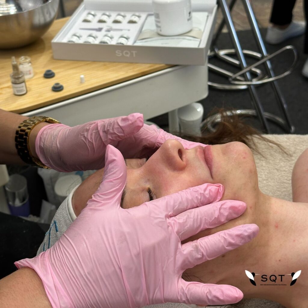 SQT biomicroneedling tretma v salonu